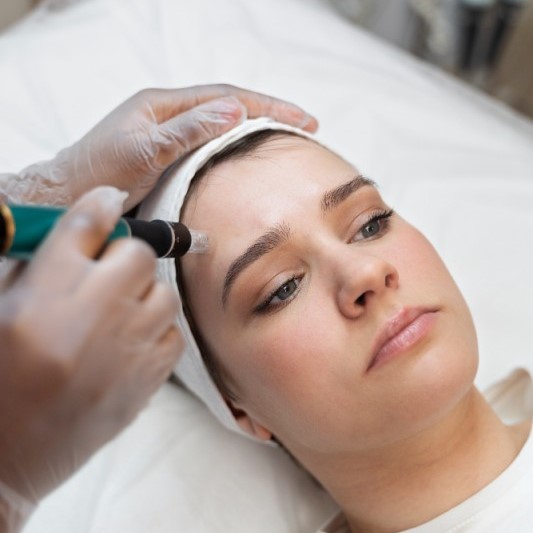 dermabrasion