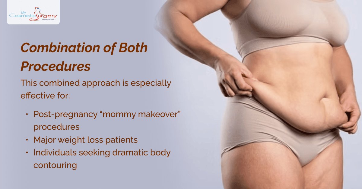 Tummy Tuck vs Liposuction