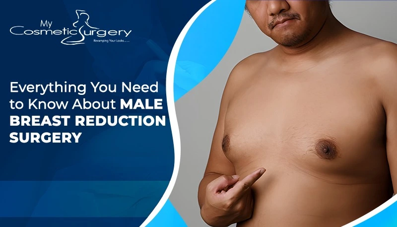 Male breast reduction Lucknow