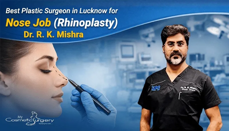 Nose Job in Lucknow – Advanced Rhinoplasty