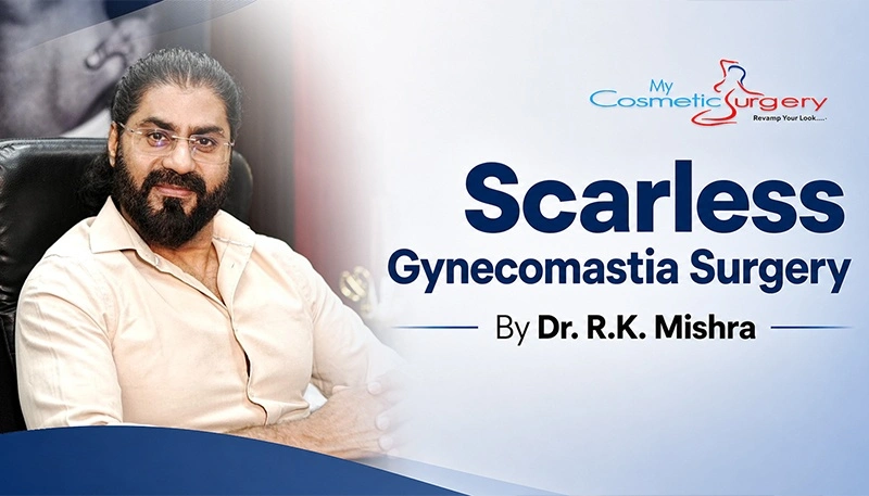 Nearly scarless gynecomastia surgery using advanced Trans Nipple technique before and after results