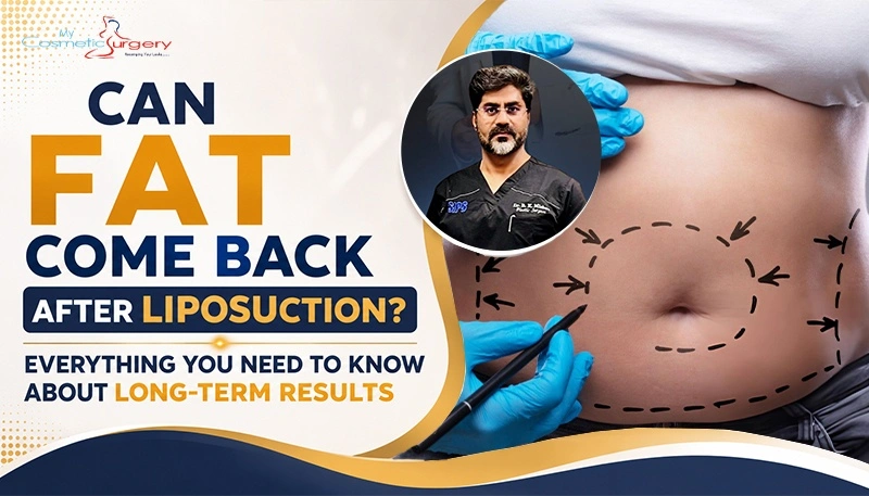 Can Fat Come Back After Liposuction