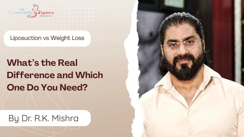 Liposuction vs Weight Loss