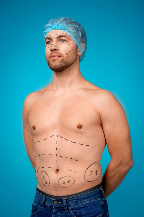 Fat Grafting (Fat Transfer) Surgery in Lucknow