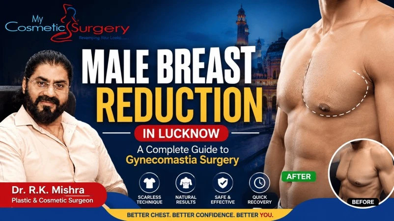 Male Breast Reduction in Lucknow | Gynecomastia Surgery Guide